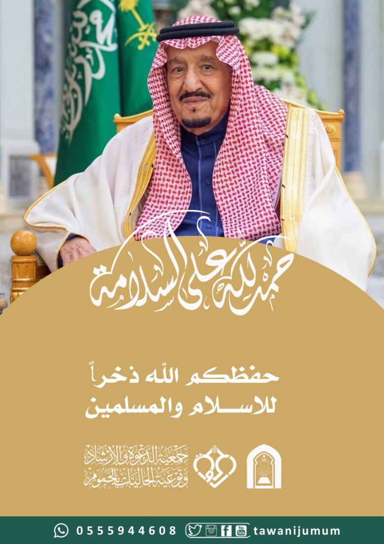 حمد لله على السلامة – خادم الحرمين الشريفين